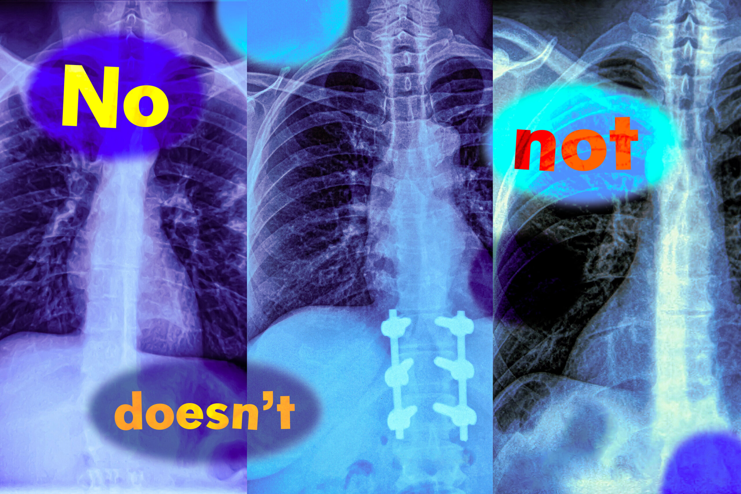 Study shows vision-language models can’t handle queries with negation words | MIT News