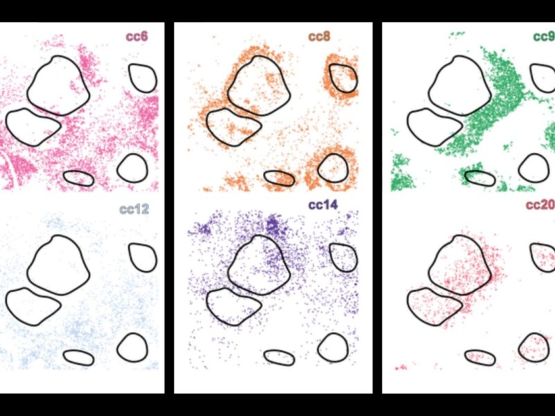 New AI system uncovers hidden cell subtypes, boosts precision medicine | MIT News